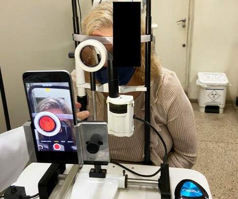 USP desenvolve tecnologia para exame de fundo de olho com celular